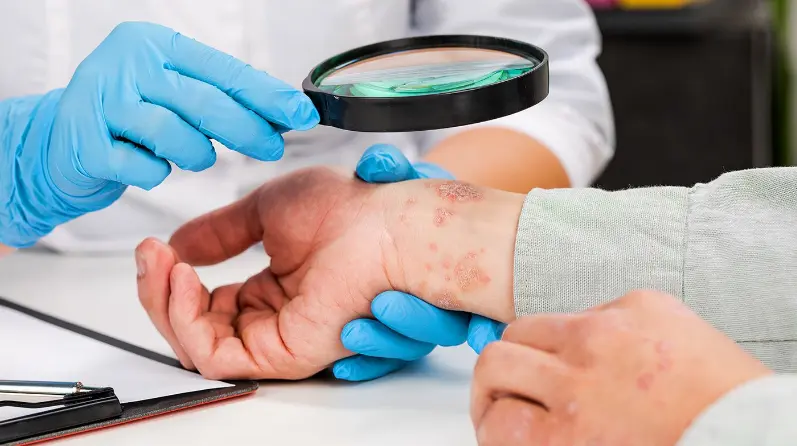 أفضل دكتور جلدية في مستشفى السلام الدولي 2 أفضل دكتور جلدية